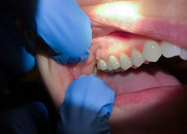 Best Emergency TMJ Treatment in Prunedale, CA