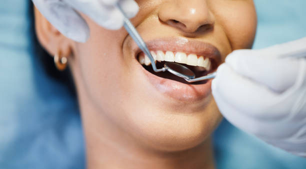 Best Emergency Dental Care for Broken or Chipped Teeth in Prunedale, CA